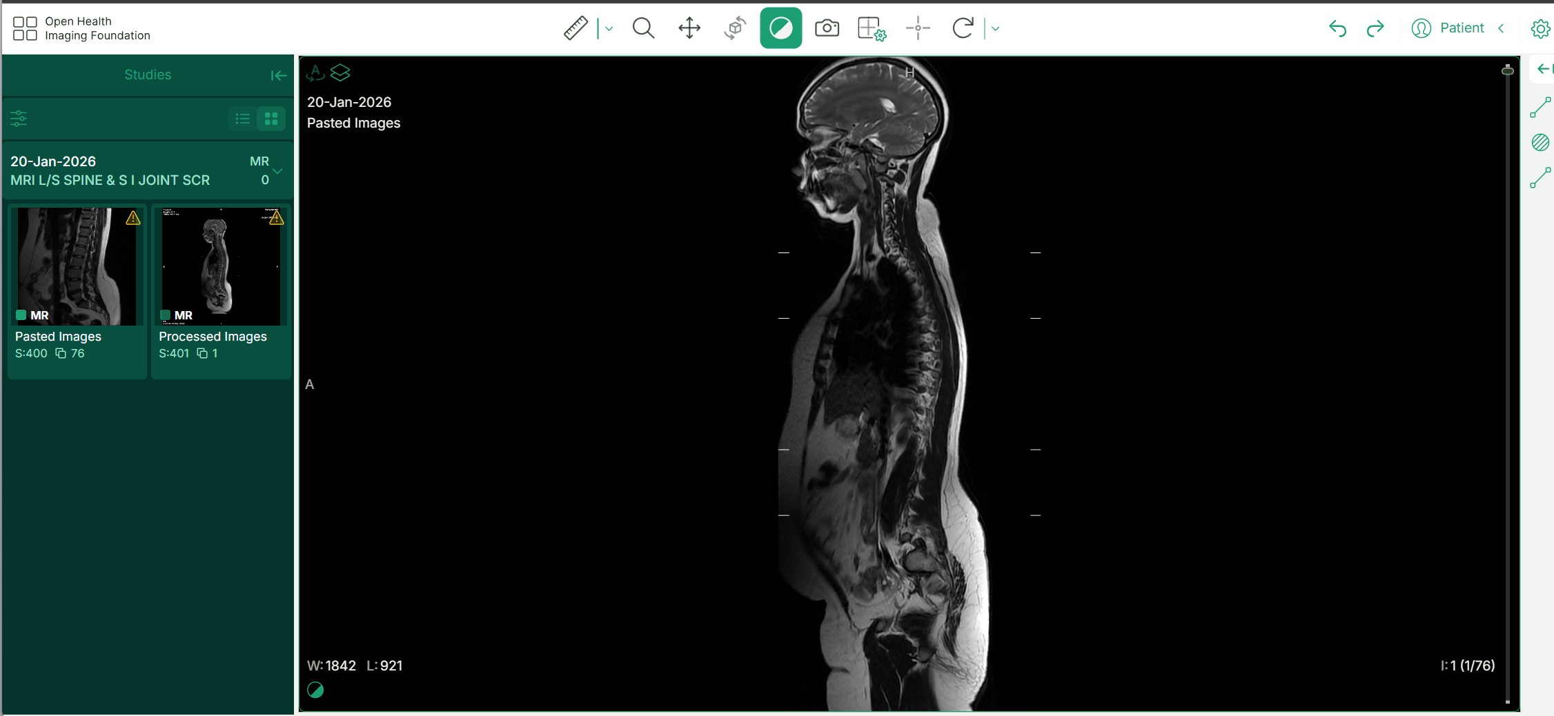 The DICOM viewer opened on an allocated study