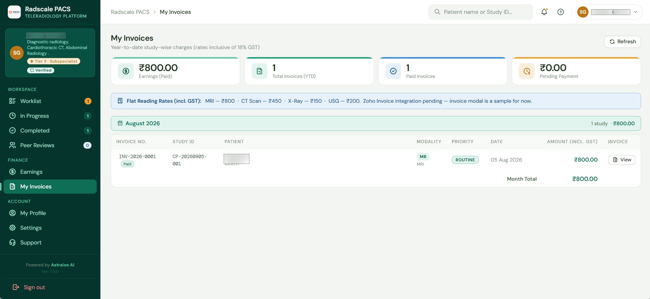 Earnings Analytics screen